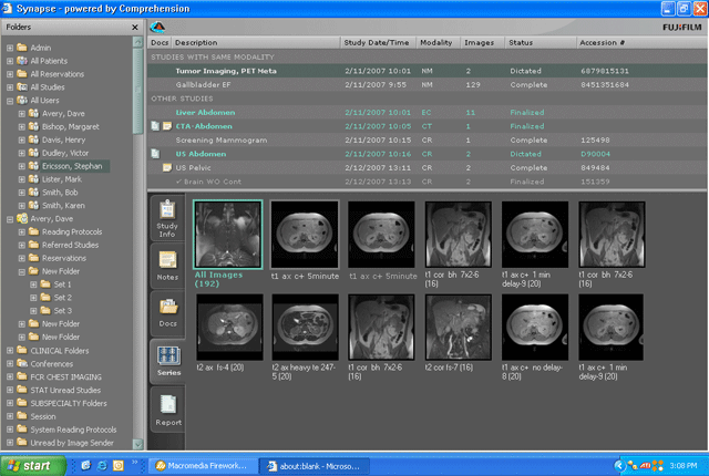 picture archiving and communication system (radiology product)
